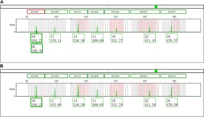 Excessive addition split peak formed by the non-templated nucleotide addition property of Taq DNA polymerase after PCR amplification